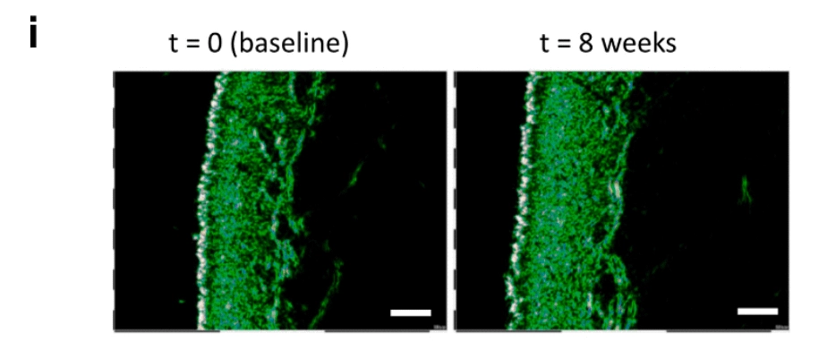 2 Kiwis a day increased skin density by 50% after 8 weeks image